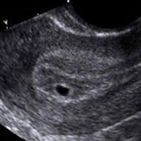 Baby's Development in the First Trimester
